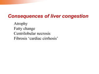 Consequences of liver congestion
Atrophy
Fatty change
Centrilobular necrosis
Fibrosis ‘cardiac cirrhosis’
 