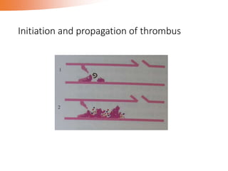 Initiation and propagation of thrombus
 