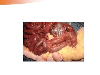 Hemodynamic disorders 