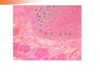 Hemodynamic disorders 