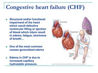 Congestive heart failure (CHF)
 Structural and/or functional
impairment of the heart
which result defective
ventricular filling or ejection
of blood which intern result
in edema, fatigue, shortness
of breath…
 One of the most common
causes generalized edema
 Edema in CHF is due to
increased capillary
hydrostatic pressure.
 