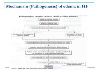Mechanism (Pathogenesis) of edema in HF
 