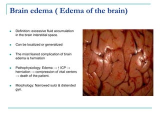 Brain edema ( Edema of the brain)
 Definition: excessive fluid accumulation
in the brain interstitial space.
 Can be localized or generalized
 The most feared complication of brain
edema is herniation
 Pathophysiology: Edema → ↑ ICP →
herniation → compression of vital centers
→ death of the patient.
 Morphology: Narrowed sulci & distended
gyri.
 