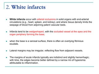2. White infarcts
 White infarcts occur with arterial occlusions in solid organs with end-arterial
circulations (e.g., heart, spleen, and kidney), and where tissue density limits the
seepage of blood from adjoining patent vascular beds.
 Infarcts tend to be wedgeshaped, with the occluded vessel at the apex and the
organ periphery forming the base;
 when the base is a serosal surface, there is often an overlying fibrinous
exudate.
 Lateral margins may be irregular, reflecting flow from adjacent vessels.
 The margins of acute infarcts typically are indistinct and slightly hemorrhagic;
with time, the edges become better defined by a narrow rim of hyperemia
attributable to inflammation.
 