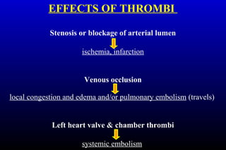 EFFECTS OF THROMBI
Stenosis or blockage of arterial lumen
ischemia, infarction
Venous occlusion
local congestion and edema and/or pulmonary embolism (travels)
Left heart valve & chamber thrombi
systemic embolism
 