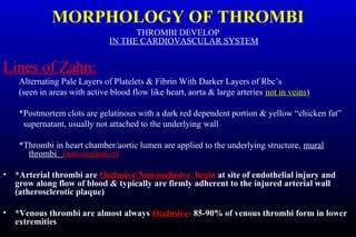 MORPHOLOGY OF THROMBI
THROMBI DEVELOP
IN THE CARDIOVASCULAR SYSTEM
Lines of Zahn:
Alternating Pale Layers of Platelets & Fibrin With Darker Layers of Rbc’s
(seen in areas with active blood flow like heart, aorta & large arteries not in veins)
*Postmortem clots are gelatinous with a dark red dependent portion & yellow “chicken fat”
supernatant, usually not attached to the underlying wall
*Thrombi in heart chamber/aortic lumen are applied to the underlying structure, mural
thrombi (non-occlusive)
• *Arterial thrombi are Occlusive/Non-occlusive, begin at site of endothelial injury and
grow along flow of blood & typically are firmly adherent to the injured arterial wall
(atherosclerotic plaque)
• *Venous thrombi are almost always Occlusive- 85-90% of venous thrombi form in lower
extremities
 