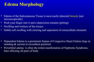 Edema Morphology
• Edema of the Subcutaneous Tissue is most easily detected Grossly (not
microscopically)
• Push your finger into it and a depression remains (pitting)
• Swelling and wetness of the tissues
• Subtle cell swelling with clearing and separation of extracellular elements
• Dependent Edema is a prominent feature of Congestive Heart Failure (legs in
standing & sacrum in recumbent position)
• Periorbital edema is often the initial manifestation of Nephrotic Syndrome,
later affecting all parts of body
 
