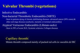Valvular Thrombi (vegetations)
Infective Endocarditis
Non-bacterial Thrombotic Endocarditis (NBTE)
-Seen in patients dying of chronic debilitating diseases- advanced cancer (50% cases) &
other end stage diseases (cachectic, marantic or terminal endocarditis)
Atypical Verrucous Endocarditis (Libman-sacks)
-Seen in 50% of acute SLE, Systemic sclerosis, Collagen diseases
Capillary thrombi
Minute thrombi composed mainly of packed red cells in vasculitis & DIC
 