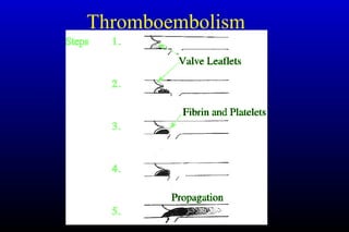 Thromboembolism
 