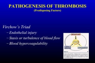 PATHOGENESIS OF THROMBOSIS
(Predisposing Factors)
Virchow’s Triad
– Endothelial injury
– Stasis or turbulence of blood flow
– Blood hypercoagulability
 