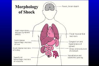 Morphology
of Shock
 