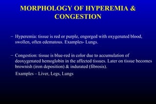 MORPHOLOGY OF HYPEREMIA &
CONGESTION
– Hyperemia: tissue is red or purple, engorged with oxygenated blood,
swollen, often edematous. Examples- Lungs.
– Congestion: tissue is blue-red in color due to accumulation of
deoxygenated hemoglobin in the affected tissues. Later on tissue becomes
brownish (iron deposition) & indurated (fibrosis).
Examples – Liver, Legs, Lungs
 
