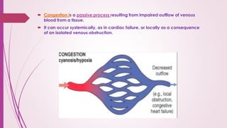Comprehensive Overview of Hemodynamic Disorders, Thromboembolism, and ...