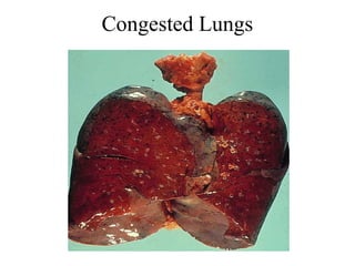 Congested Lungs

 