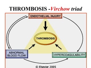 THROMBOSIS -Virchow triad

 