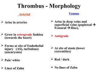 Thrombus - Morphology
Venous

Arterial
 Arise in arteries

 Arise in deep veins and
superficial veins (popleteal 
Femoral Iliac),

 Grow in retrograde fashion
(towards the heart)

 Antigrade

 Forms at site of Endothelial
injury (AS), turbulence
(aneurysms)

 At site of stasis (lower
extremities)

 Pale/ white

 Red / dark

 Lines of Zahn

 No lines of Zahn

 