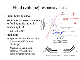 Fluid (volume) responsiveness
• Frank-Starling curve
• Volume responsive – respond
to fluid administration by
increasing C...