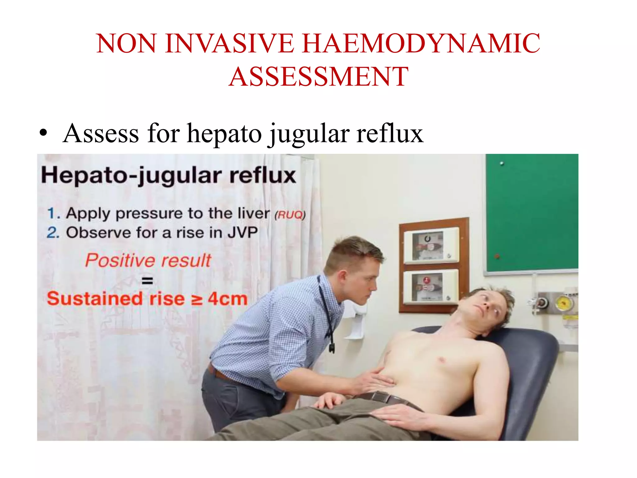 NON INVASIVE HAEMODYNAMIC
ASSESSMENT
• Assess for hepato jugular reflux
 