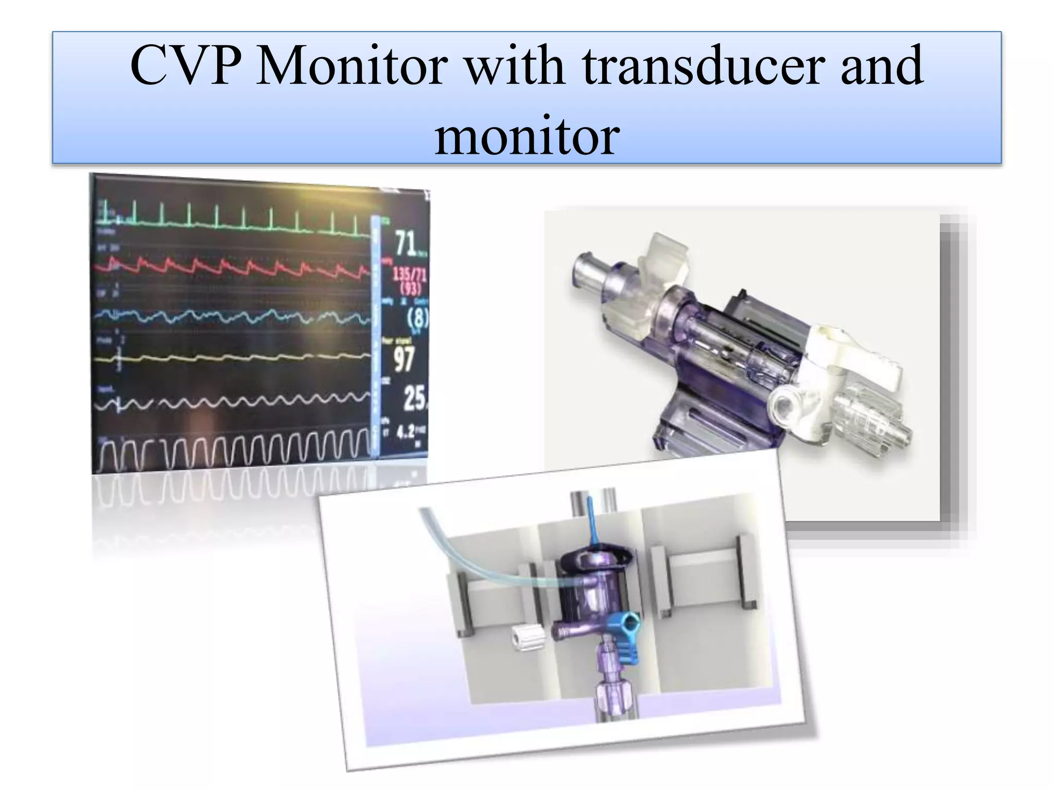 CVP Monitor with transducer and
monitor
 