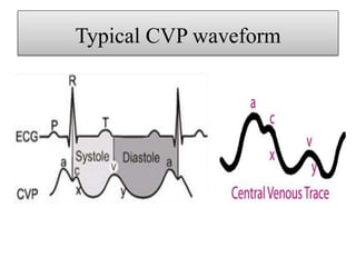 Hemodynamic monitorig | PPTX