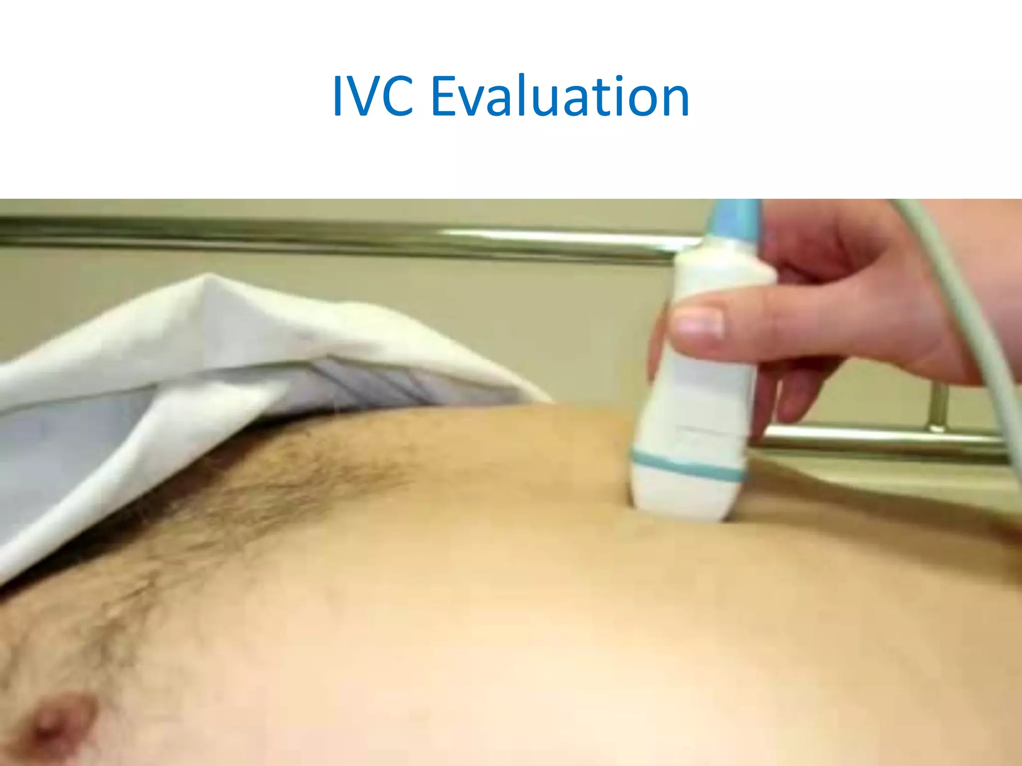 IVC Evaluation

Bassel Ericsoussi, MD

16

 