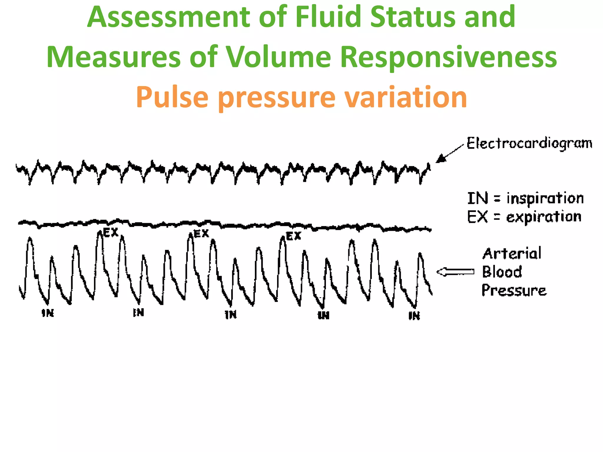 Assessment of Fluid Status and
Measures of Volume Responsiveness
Pulse pressure variation

 