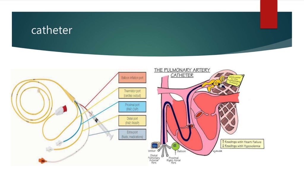 Hemodynamic monitoring