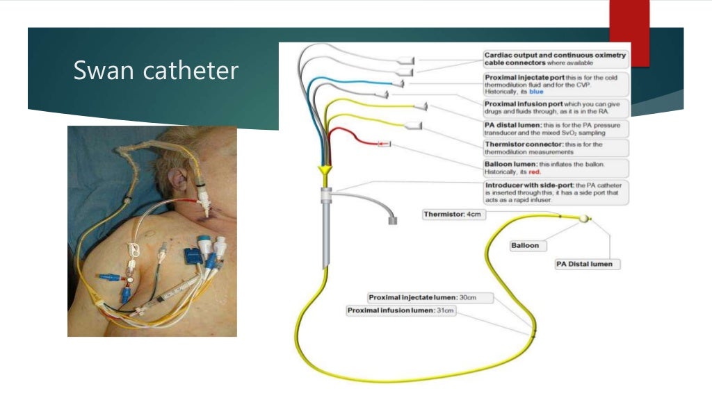 Hemodynamic monitoring