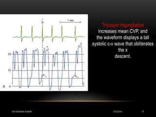 Hemodynamic monitoring | PPTX