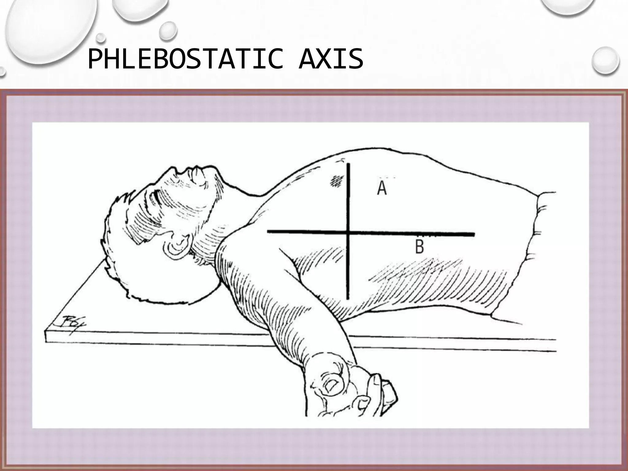 Hemodynamic monitoring