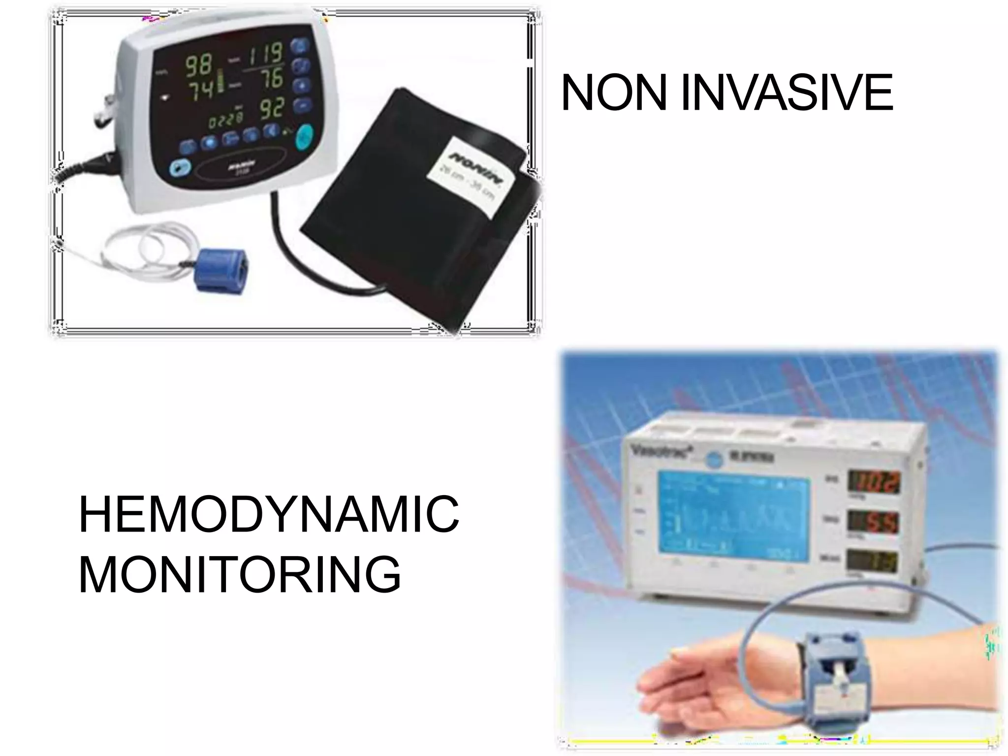 Hemodynamic monitoring
