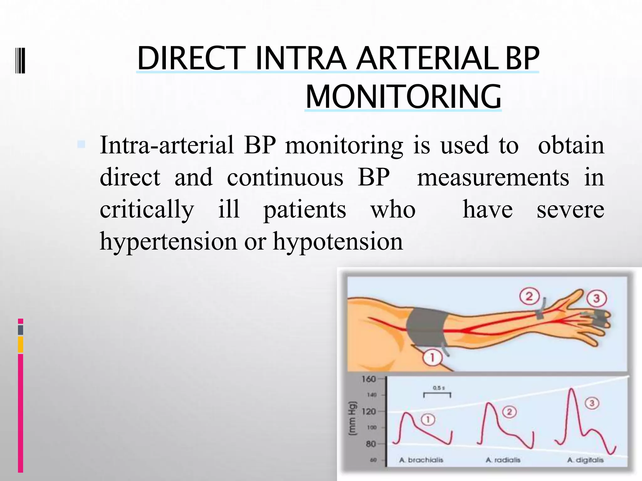 Hemodynamic monitoring