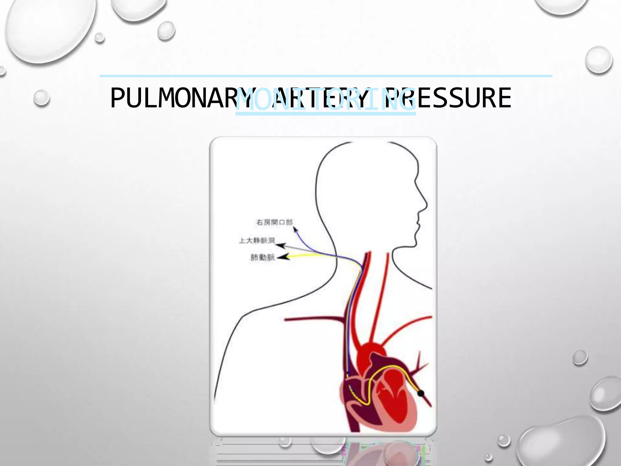 Hemodynamic monitoring