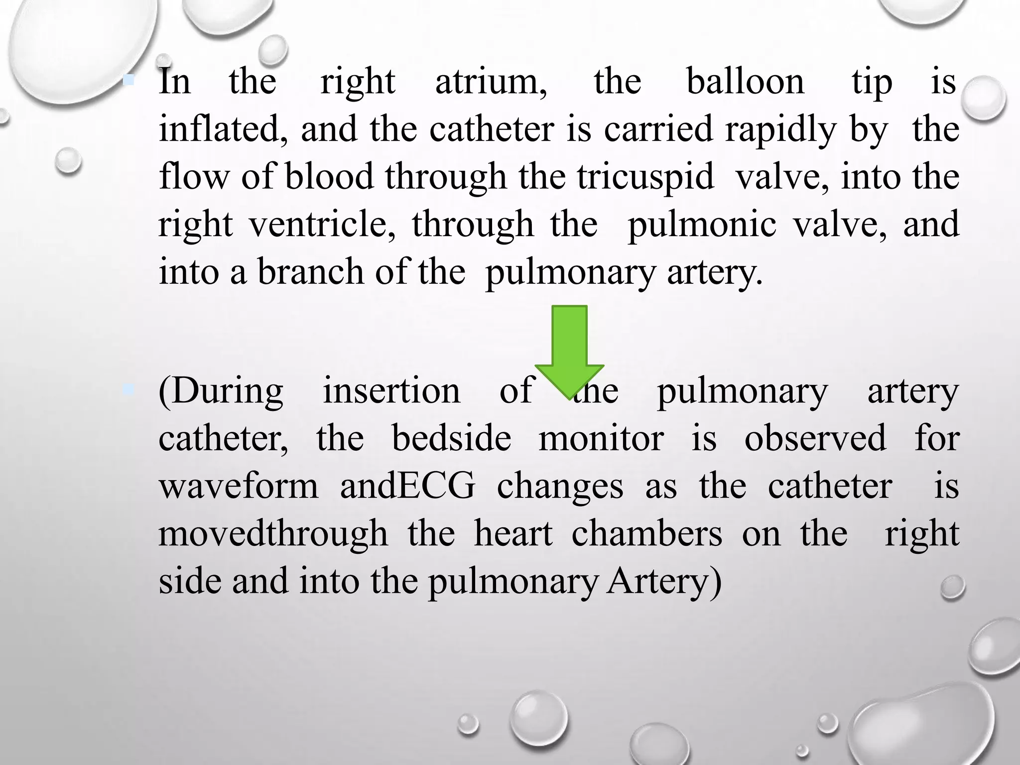 Hemodynamic monitoring