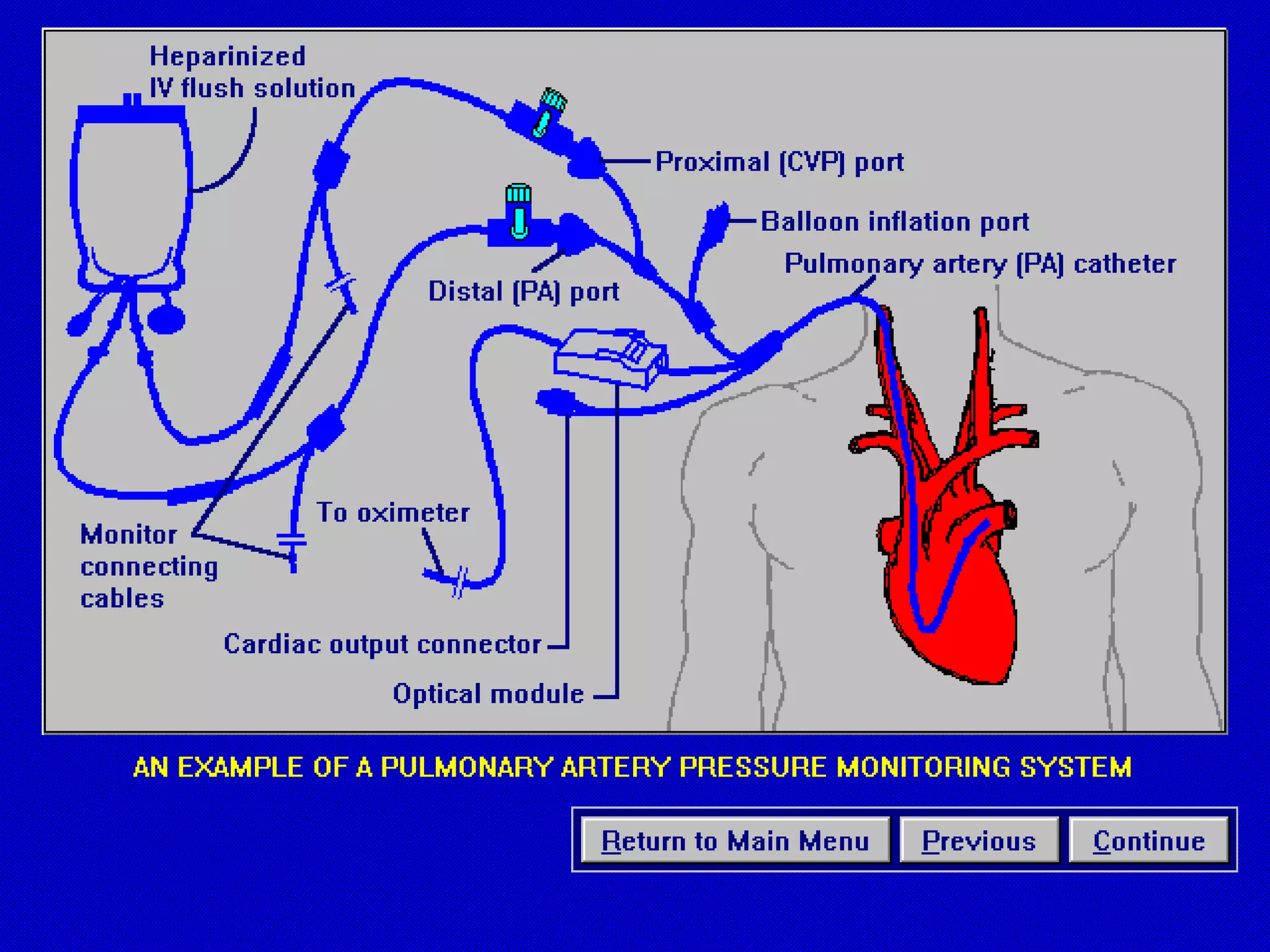 Hemodynamic monitoring