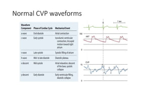 Hemodynamic monitoring.pptx