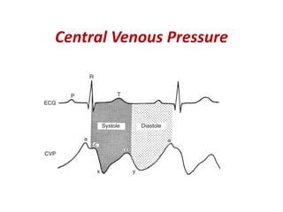 Hemodynamic Monitoring .pptx