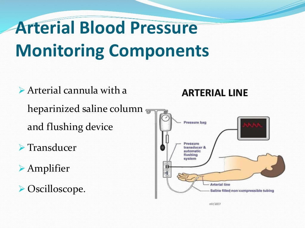 Hemodynamic monitoring in ICU