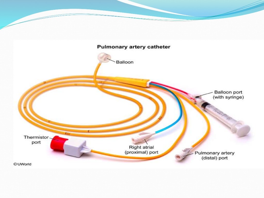 Hemodynamic monitoring in ICU