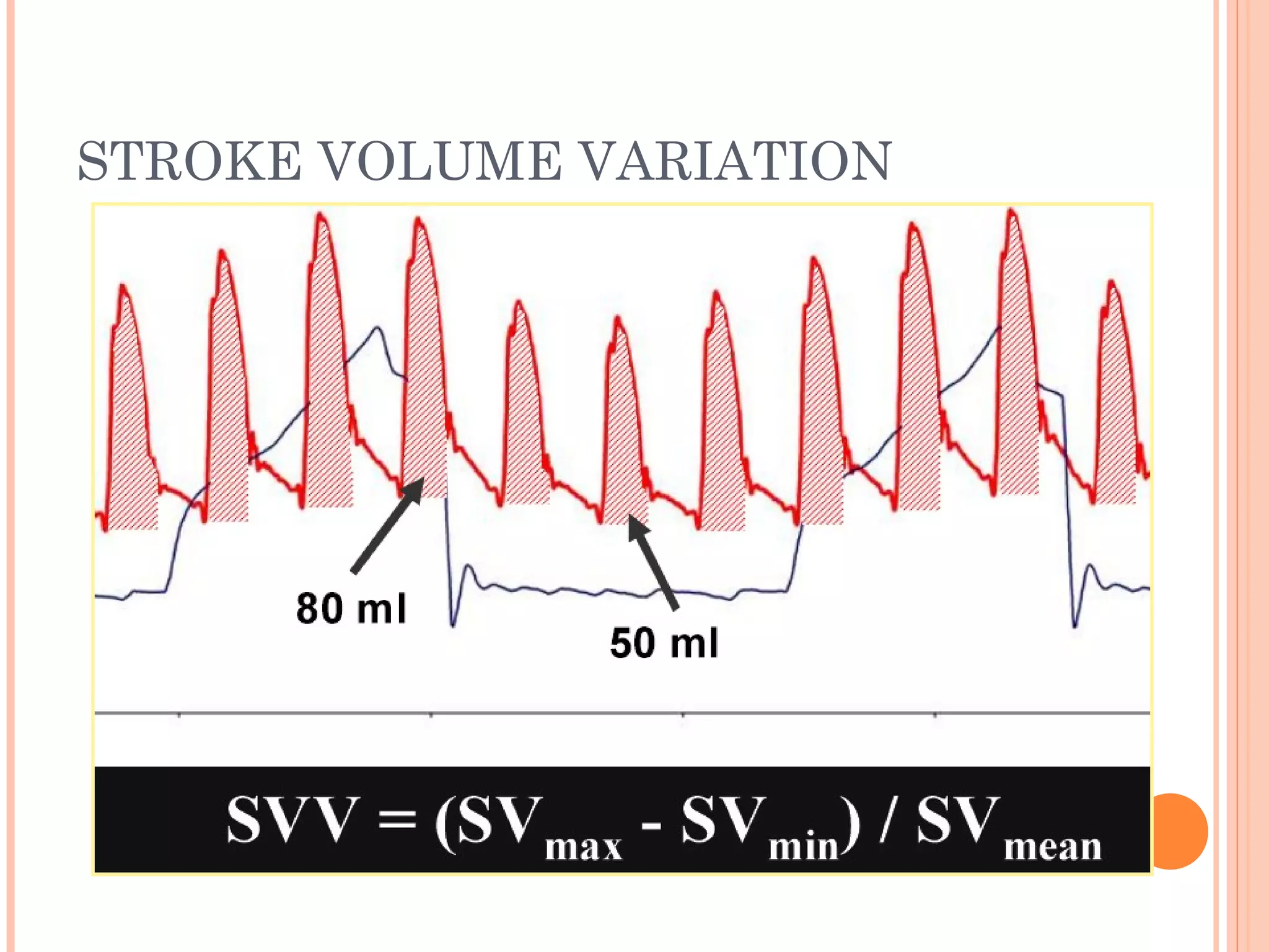 Normal Svv Hemodynamic monitoring in icu | PPT