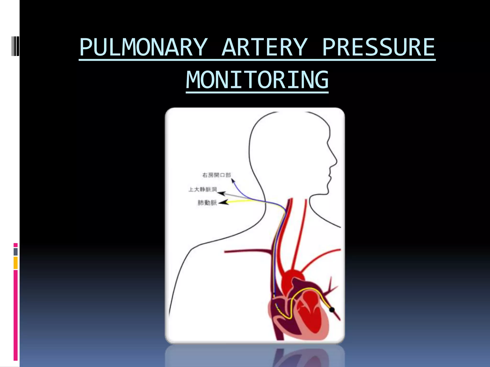 PULMONARY ARTERY PRESSURE
MONITORING

 