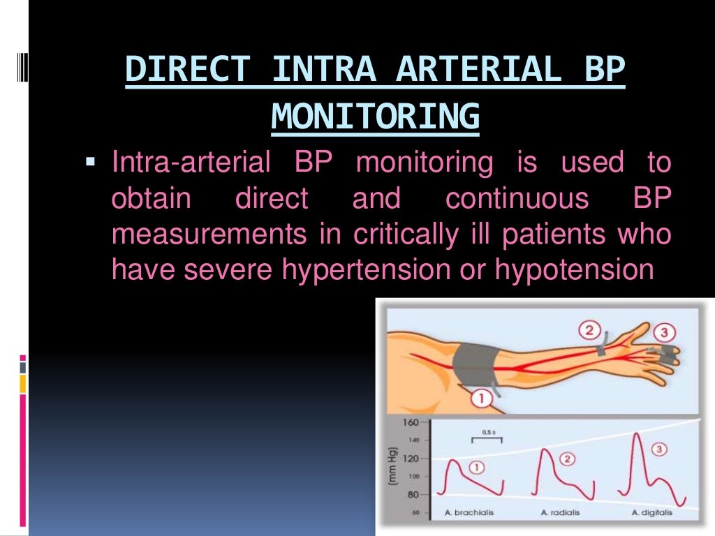 Hemodynamic monitoring ppt