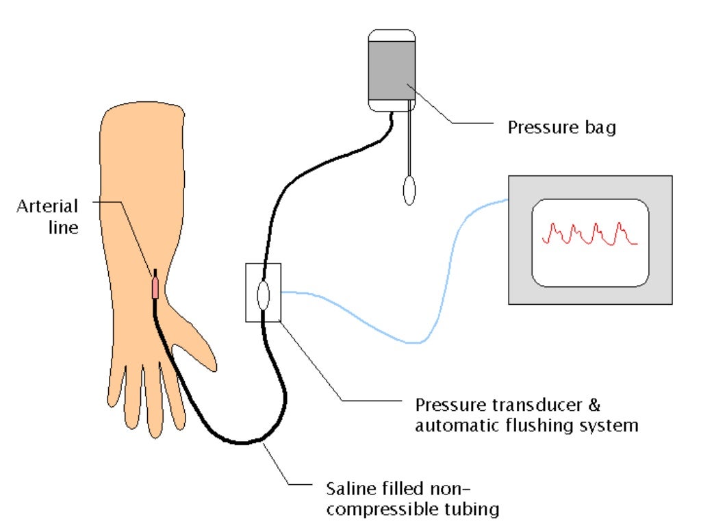 Hemodynamic monitoring ppt