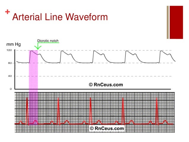 Hemodynamic monitoring r weinzierl