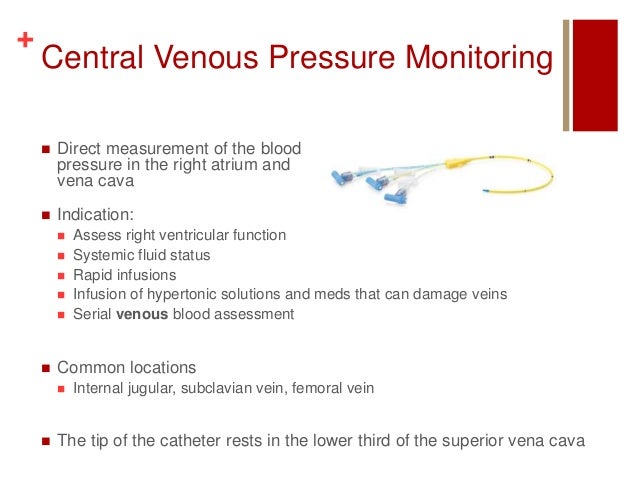 central venous pressure