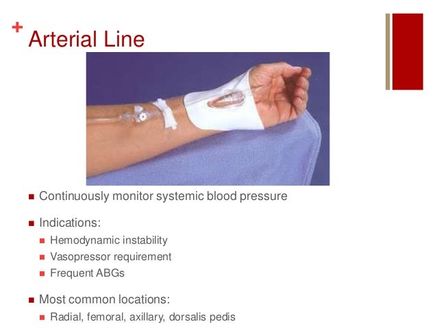 A Line Arterial Monitoring : Hemodynamic monitoring r weinzierl