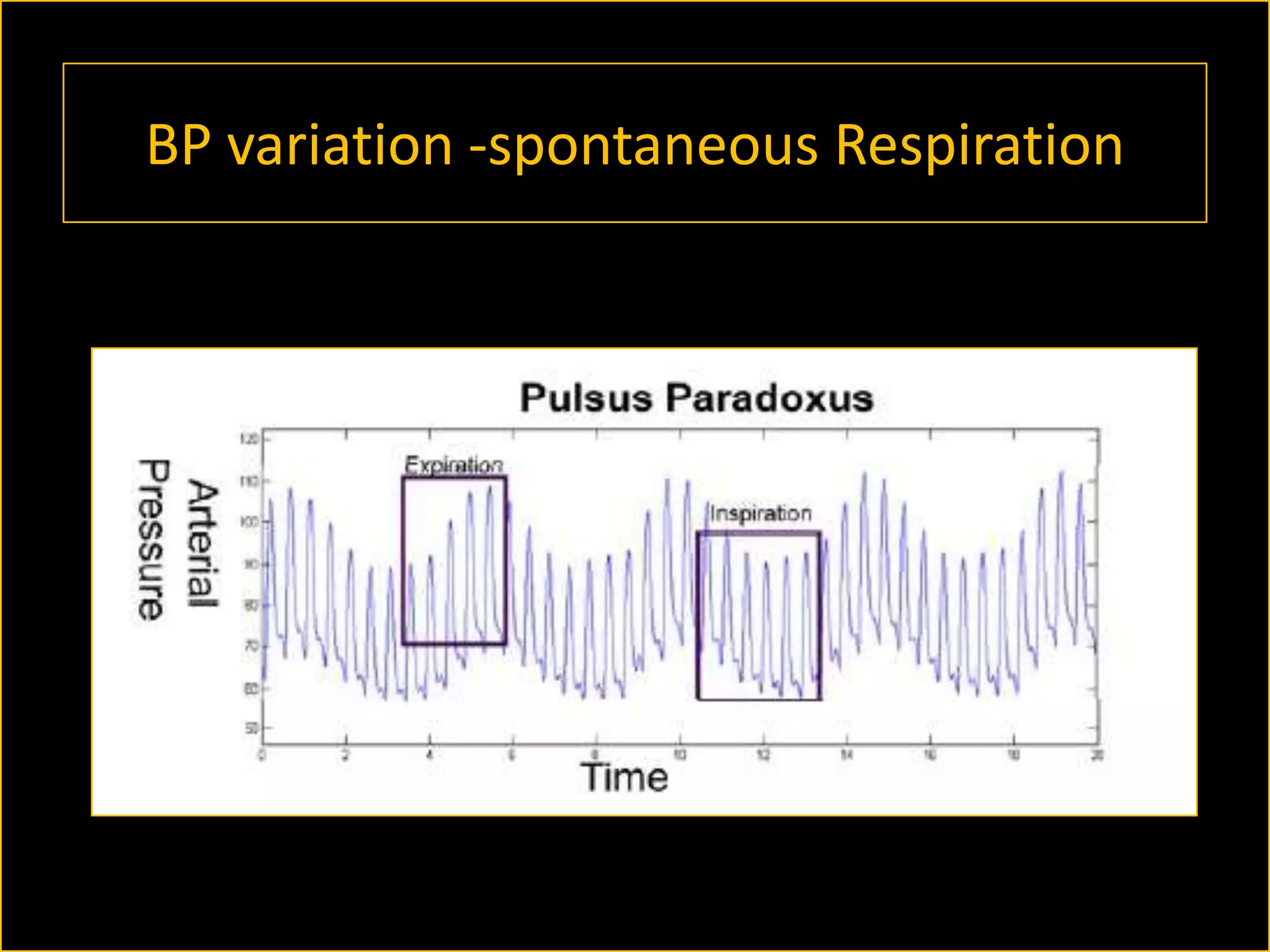 BP variation -spontaneous Respiration

 