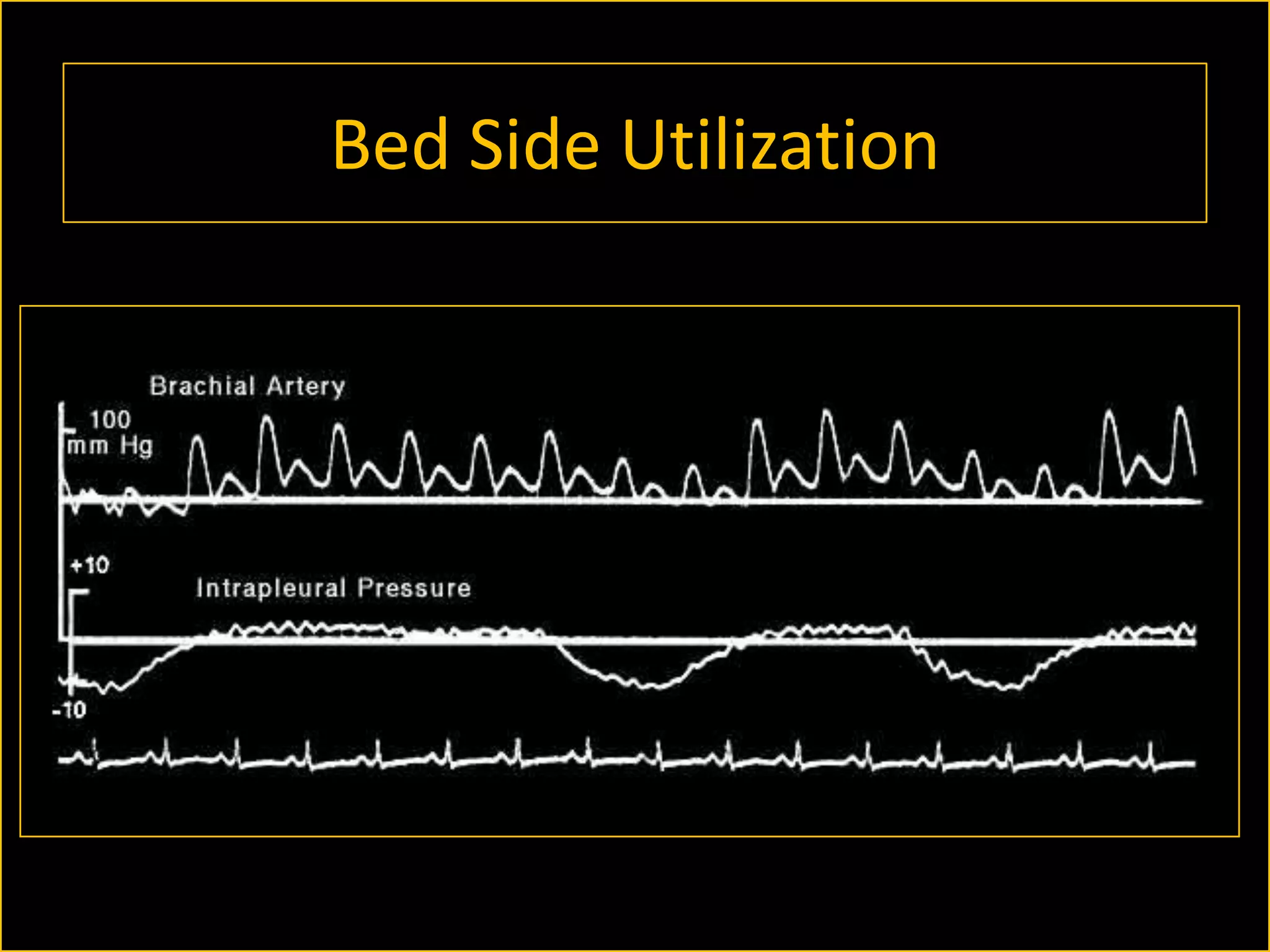 Bed Side Utilization

 