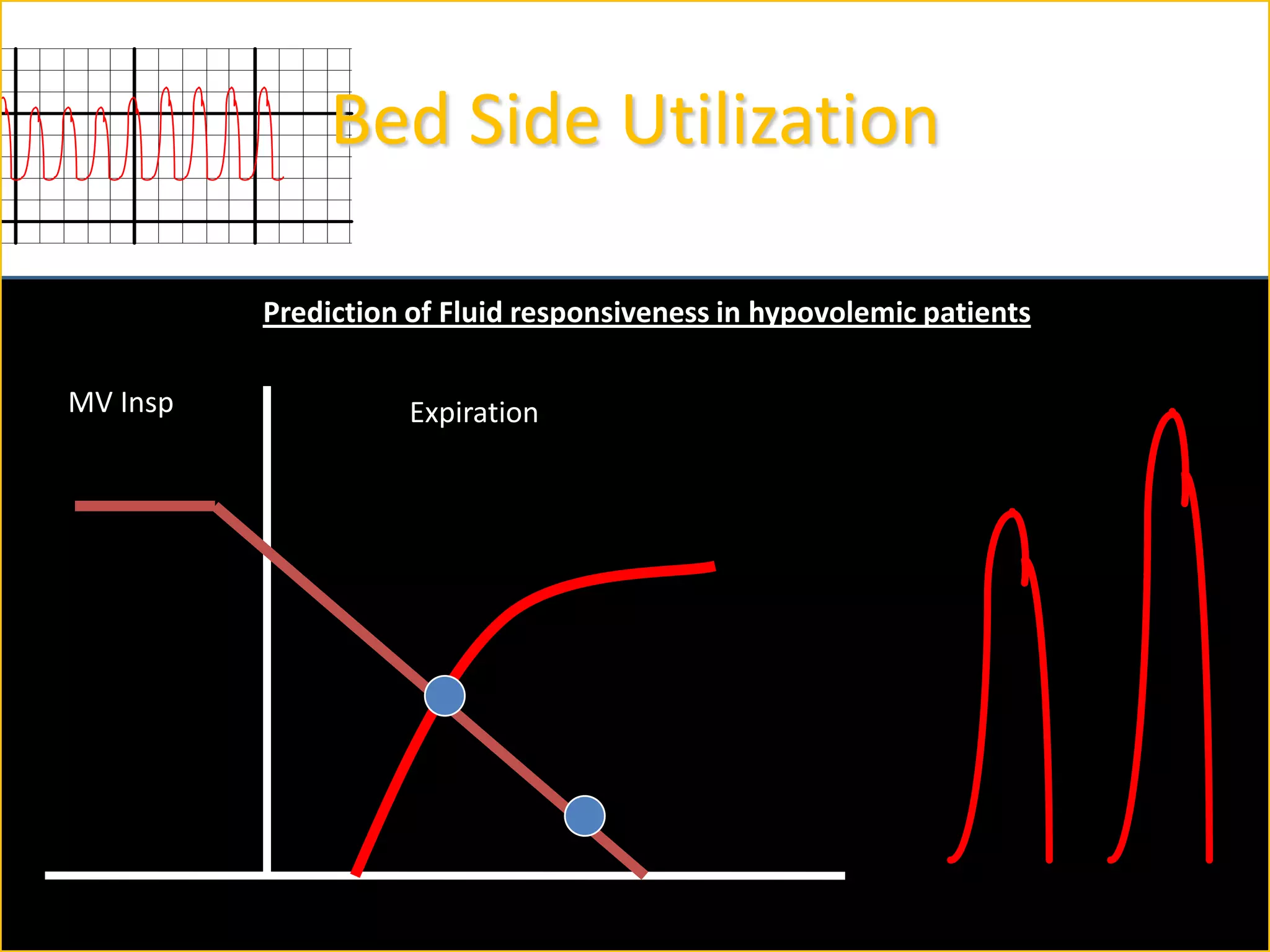 Bed Side Utilization
Prediction of Fluid responsiveness in hypovolemic patients
MV Insp

Expiration

 