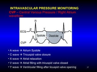 Hemodynamic Pressure Monitoring | PPT